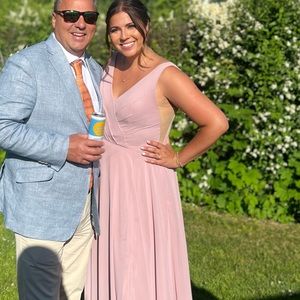 Light stain can’t tell with dress the way it folds. Open sides. Size 14